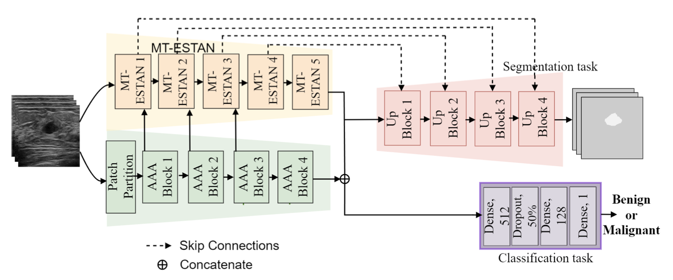 Breast Ultrasound Tumor Classification Using a Hybrid Multitask CNN-Transformer Network